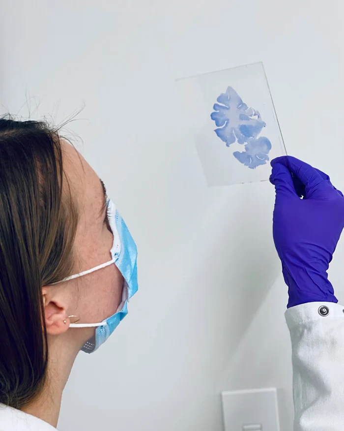 Поперечный разрез мозга сверхстарейшины. Результаты показывают, что объём его мозга аналогичен объёму мозга людей на двадцать-тридцать лет моложе | Предоставлено Тамар Гефен