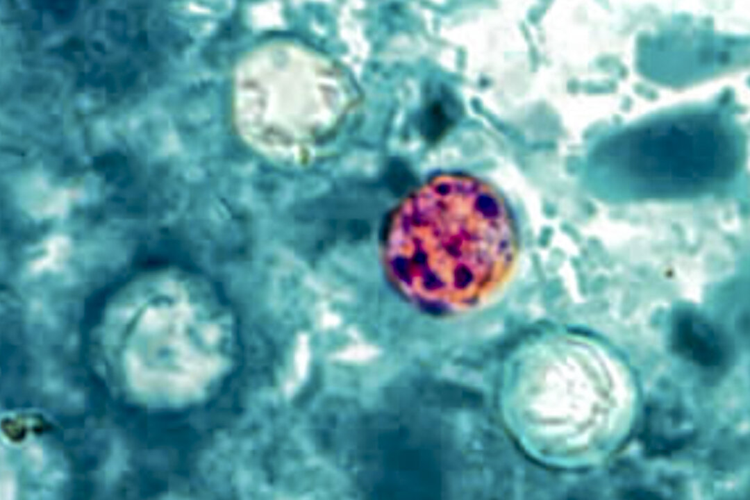 Ооцисты Cyclospora cayetanensis в образце стула на этом изображении. (CDC через The Epoch Times) | Epoch Times Media